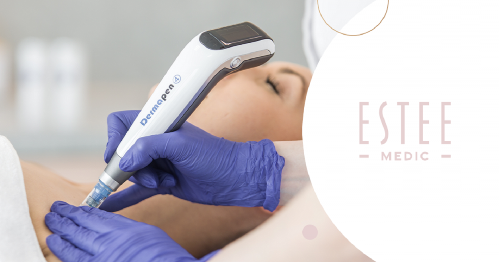 Zabiegi medycyny estetycznej